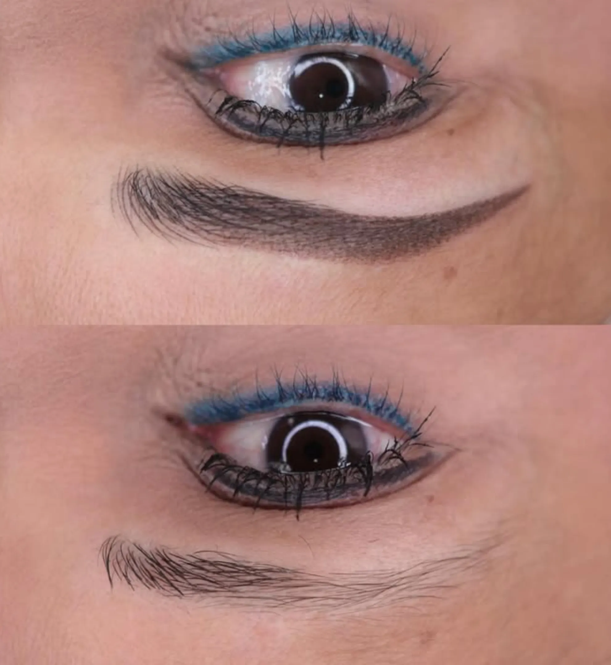 lip enhancement