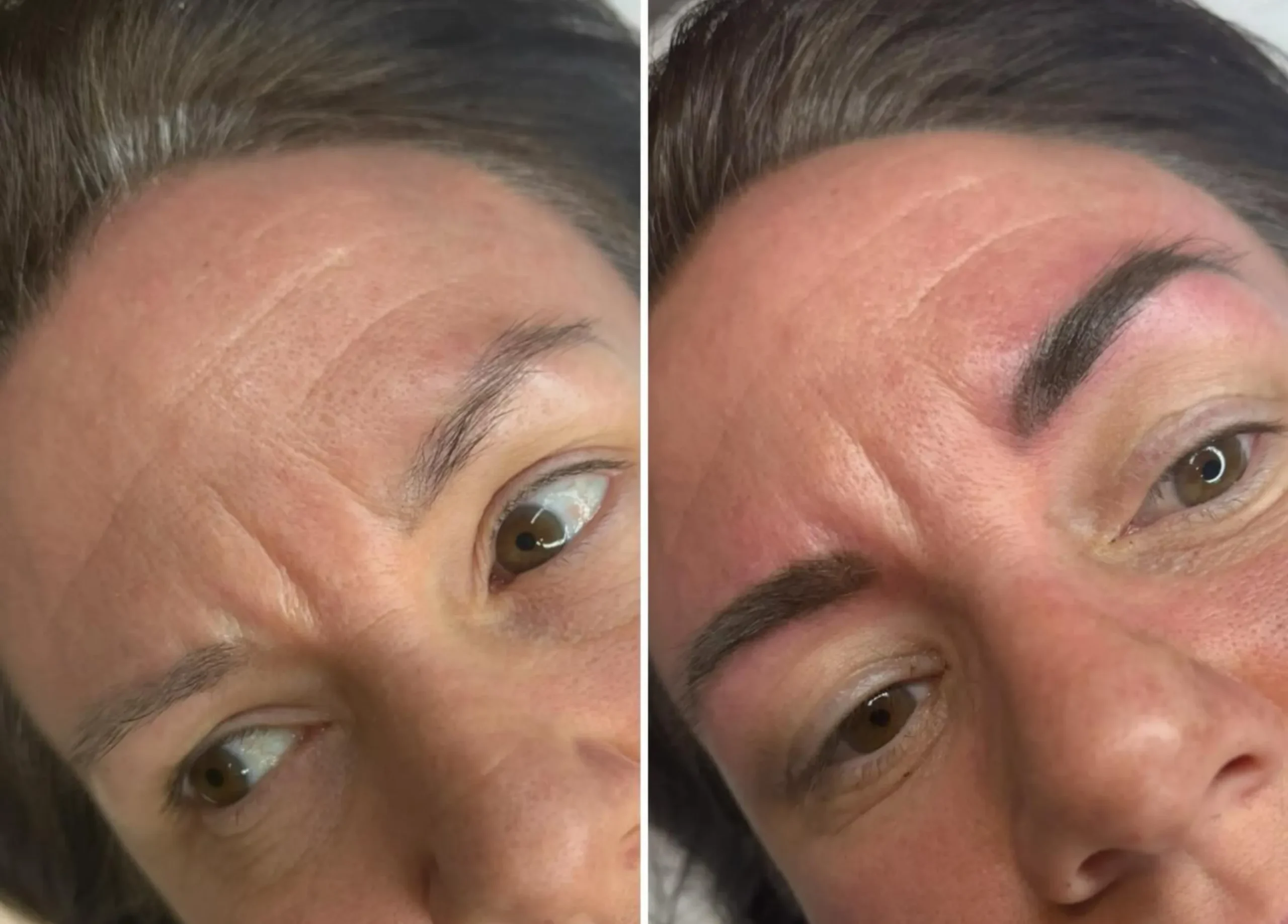 cosmetic tattoo Melbourne weather